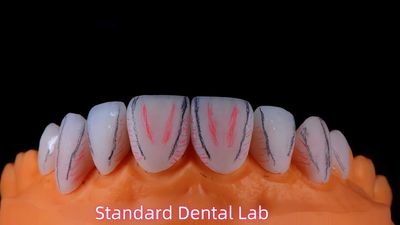 Standard Dental Lab Co., Limited خط تولید تولید کننده