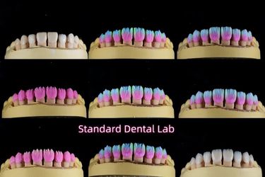 Standard Dental Lab Co., Limited خط تولید تولید کننده