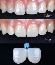 Standard Dental Lab Co., Limited خط تولید تولید کننده