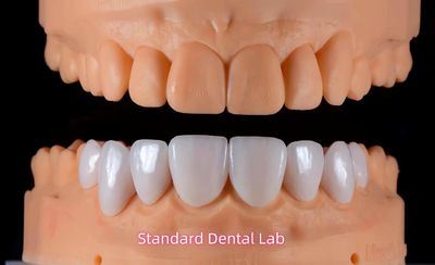 Standard Dental Lab Co., Limited خط تولید تولید کننده