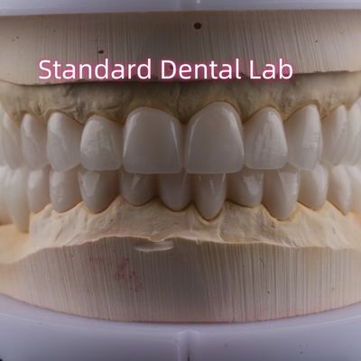 خرید آزمایشگاه دندانپزشکی کل قوس زیرکونیا تاج های چینی PFZ تاج ISO FDA CE ساخت آنلاین