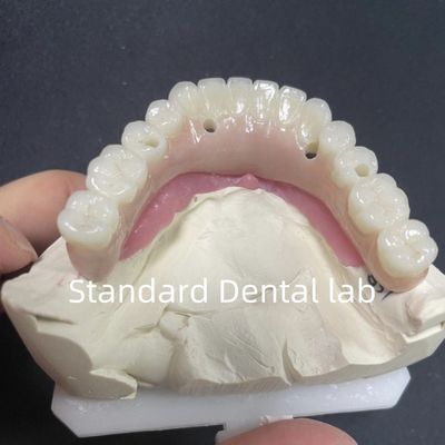 خرید بازسازی زیبایی همه در 4 ایمپلنت دندان زیرکونیا هیپو آلرژیک ساخت آنلاین