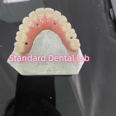 خرید همه در چهار شش ایوکلار زیرکونیا پل ایمپلنت تیتانیوم میله ای با ژامبون صورتی ساخت آنلاین