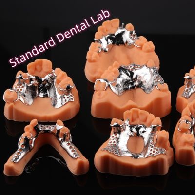 خرید CAD CAM قاب فلزی دندانهای قطعی قابل برداشت 3 شکل طراحی دندانهای Exocad ساخت آنلاین