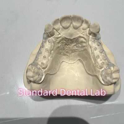خرید قاب قابل جدا کردن گچ شفاف بخش آسان برای تمیز کردن و برداشتن ساخت آنلاین