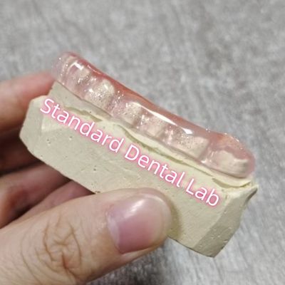 خرید بروکسیسم دندانپزشکی استخوان مغزی اسفلنت نگهبان شب آزمایشگاه دندانپزشکی استاندارد ساخت آنلاین