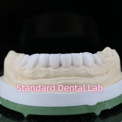 خرید تشخیصی دندانپزشکی ترمیم کننده موی دندانپزشکی ساخت آنلاین