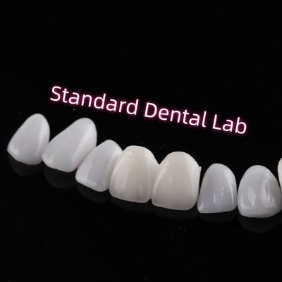 خرید مقاوم در برابر سایش Emax Zirconia لامینات veneers Translucency incisional ساخت آنلاین