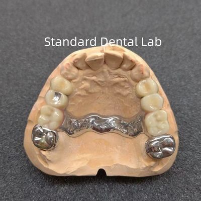 خرید دندانپزشکی قابل برداشتن دقيق و قطعي دندانپزشکی ثابت حرفه ای ساخت آنلاین