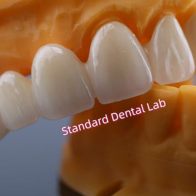 خرید CAD CAM آسیاب زرکونیا پل تاج بسیار سازگار با زیست ساخت آنلاین