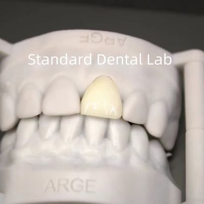 خرید تاج های آزمایشگاه دندانپزشکی دیجیتال CAD CAM تاج زرکونیا لایه دار شفاف ساخت آنلاین