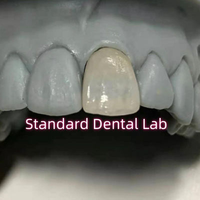 خرید دندانپزشکی ترمیم کننده Emax تاج های زرکونیا ساخت آنلاین