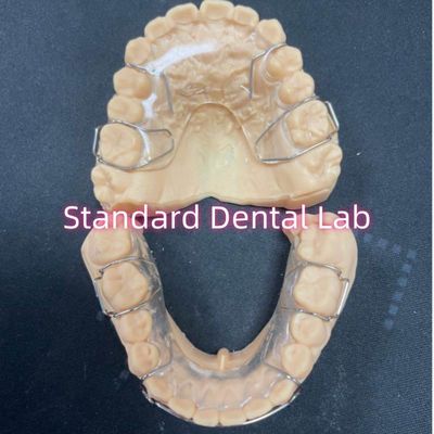 خرید نگهدارنده حرفه ای ارتودنسی آکریلیک دندانپزشکی نگهدارنده هاولی آدام کلپس ساخت آنلاین