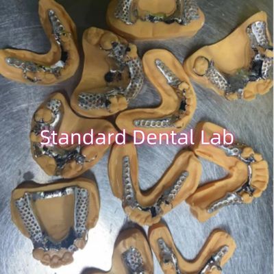 خرید دندانهای پاره ای با قاب فلزی ریخته شده کروم کوبالتی قابل جدا کردن ساخت آنلاین
