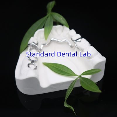 خرید Vitallium 2000 چارچوبی جزئی ISO CE و FDA چین آزمایشگاه دندانپزشکی قاب فلزی ساخت آنلاین