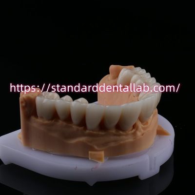 خرید FDA زیبایی بالایی دارا است. پل زرکونیا دندانپزشکی با تاج زرکونیا چینی چین ساخت آنلاین