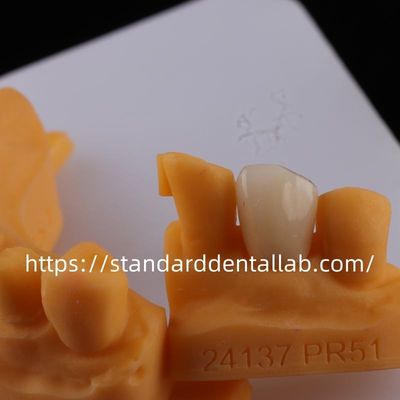 خرید تاج های لابراتوار دندانپزشکی Full Contour تاج های لابراتوار دندانپزشکی چین ساخت آنلاین