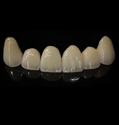 خرید تاج زرکونیا راحت با تناسب خوب و زیبایی دقیق ساخت آنلاین