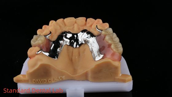 خرید CorCr فلزی پروتز جزئی روشنگری بالا بیریلیوم آزاد Ivoclar Scheftner Framewrok فلزی راحت ساخت آنلاین