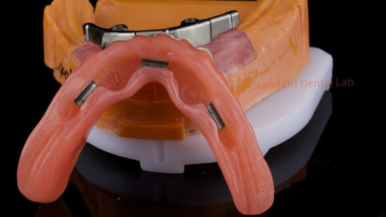 خرید دندانهای کاشت شده ایوکلار دیجیتال دندانهای کاشت شده ایوکلار دیجیتال دندانهای کاشت شده ایوکلار دیجیتال ساخت آنلاین