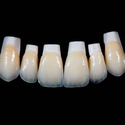 خرید تاج فرش پورسلینی با شفافیت بالا توسط Ivoclar Vivadent ساخت آنلاین