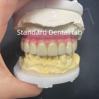 پل مالو هیبرید زرکونیا همه در چهار / شش زرکونیا پل کاشت