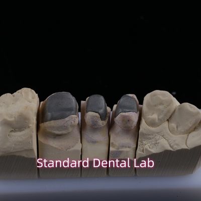 فلزی Cast Post Core Crown Cocr Accurate Retentive Full Zirconia Bruxier از سنگ زرکونیا استفاده می شود