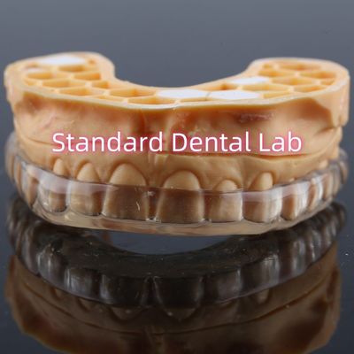 محافظ دندان ضد خروپف حرفه ای محافظ دهان شبانه ارتقا یافته برای خرد کردن دندان