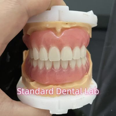 لابراتوار دندانپزشکی استاندارد OEM دندانهای کامل قابل برداشتن آسان برای برداشتن و خارج کردن