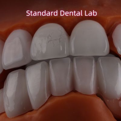 لایه لیتیوم دیسیلیکات Ivoclar Emax Zirconia Laminate Veneers شفاف OEM ODM