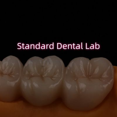 پل زیرکونیای لایه دار فرش سرامیکی