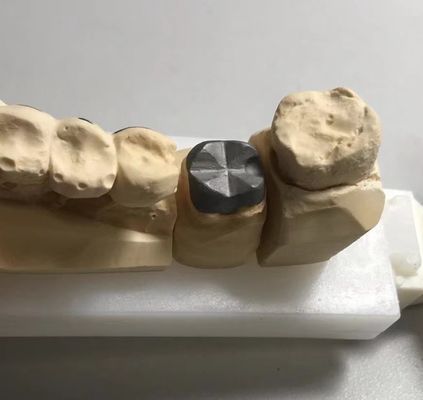 ISO FDA CE استایل فلزی دندانپزشکی و کرون هسته ای PFM مناسب است