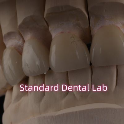 لابراتوار دندانپزشکی حرفه ای تاج زیرکونی برای بازسازی ثابت