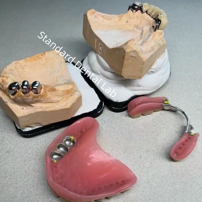 زیبایی شناسی بالا CAD CAM دندان متصدی پروتز جزئی جایگزینی آزمایشگاه دندانپزشکی استاندارد