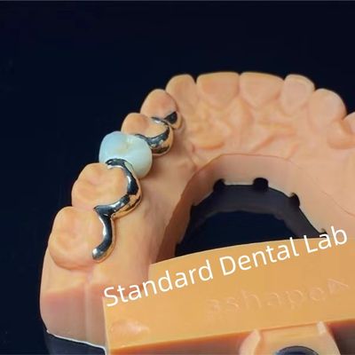 دندانپزشکی PFM پل مریلند زیبایی شناسی بالا FDA گواهینامه