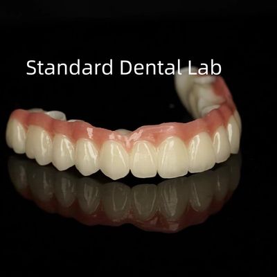 استاتیک پورسلین تک فلزی تاج زیرکونیا کامل قوس شفافیت