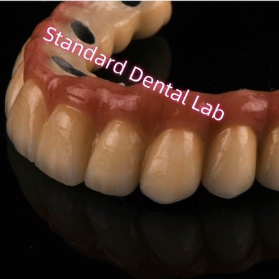 کوبالت کروم Ivoclar لیزر سینتر شده PFM تاج فلزی پورسلین پل A1 A2 A3