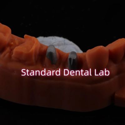 تاج هسته فلزی CAD CAM پورسلین / زرکونیا با تاج های کامل زرکونیا بروکسیر