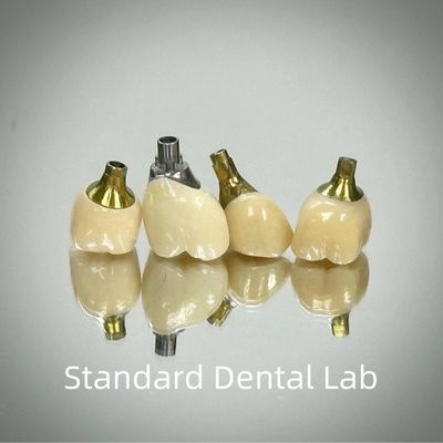 حرفه ای زرکونیا پیچ نگهداری ایمپلنت تاج تیتانیوم CAD CAM
