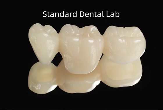 CAD CAM خالی PMMA پل موقت دندانپزشکی