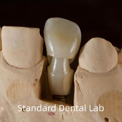 ایمپلنت دندان Tibase Zirconia Abutment تیتانیوم دقت سفارشی