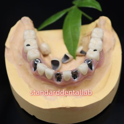 کلاهک های سرامیکی فلزی