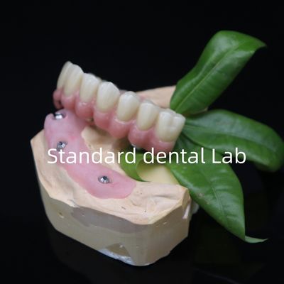 تمام 6 تا از پل زيرکونيايي درست و دقيق