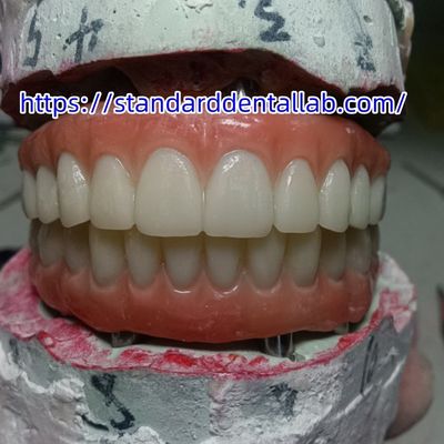ایمپلنت دندان تاج موقت پل PMMA با پورسلین صورتی