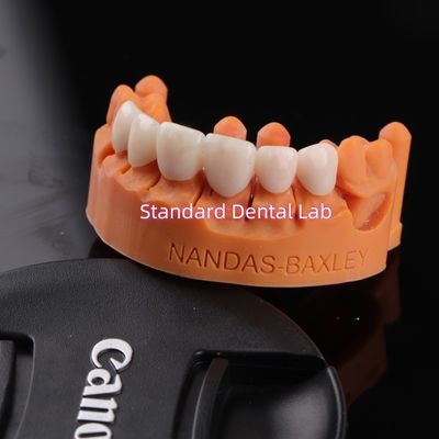 راحتی و عملکرد با آزمایشگاه دندانپزشکی CAD CAM دیجیتال پل زیرکونیای لایه دار شفاف