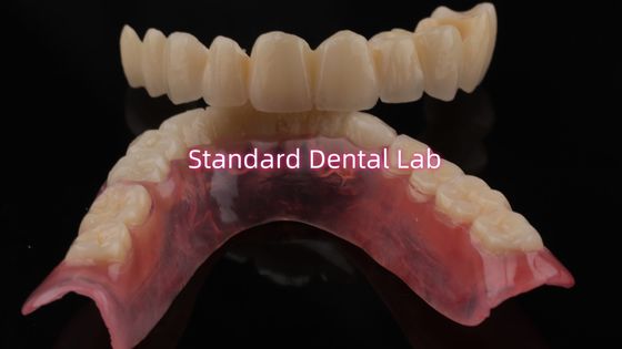 بسیار با دوام و طبیعی به نظر می رسد پرت شده پورسلین برای طبقات دندانپزشکی Zirconia تاج چین آزمایشگاه دندانپزشکی