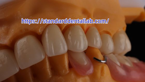 تاج و پل زرکونیا متراکم 3D PRO تاج زرکونیا پورسلین