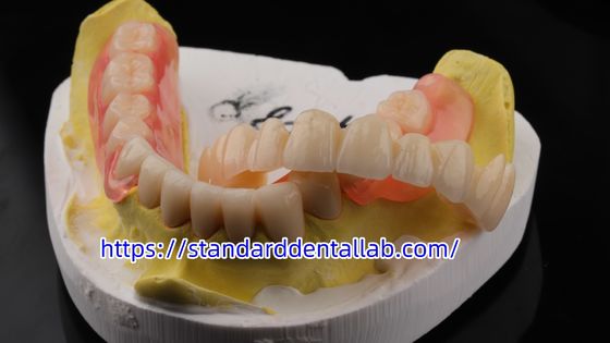 زیبایی بالا دندان TCS Valplast انعطاف پذیر دندان های مصنوعی جزئی آزمایشگاه دندان Valplast Clap سایه صورتی