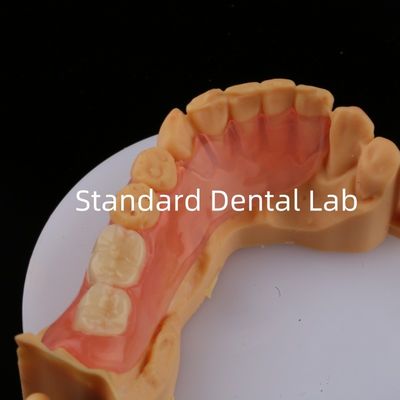 دندان های اس صورتی / تیره TCS Valplast پروتز های جزئی انعطاف پذیر برای زیبایی های بالا مدل چاپ 3D دندان