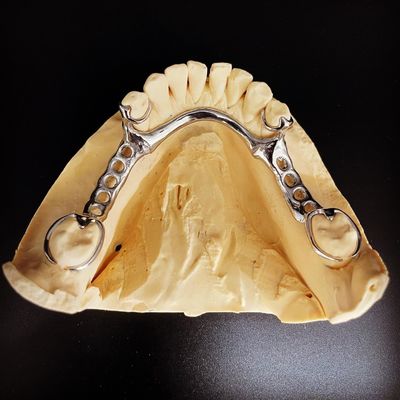 چارچوب سریع و ریخته شده برای دندانپزشکان